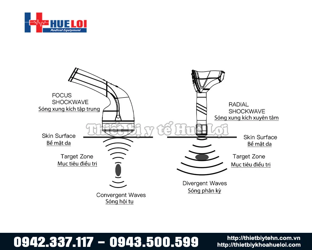 Nguyên lý tác động của hai loại sóng xung kích