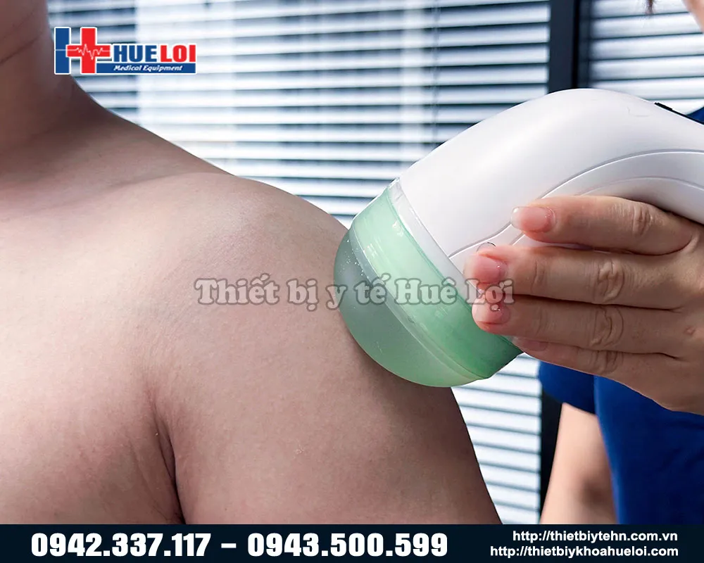 Điều trị vùng vai bằng máy xung kích Emforcus