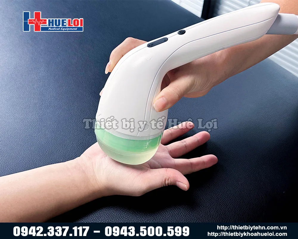 Điều trị lòng bàn tay bằng máy xung kích Emforcus