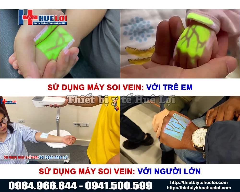 Máy soi tĩnh mạch QV-600