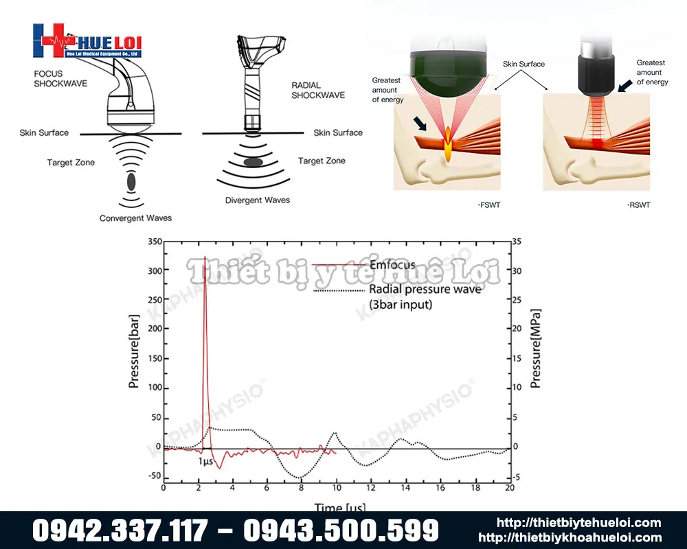 Sự khác biệt giữa sóng xung kích hội tụ và sóng xung kích phân kỳ