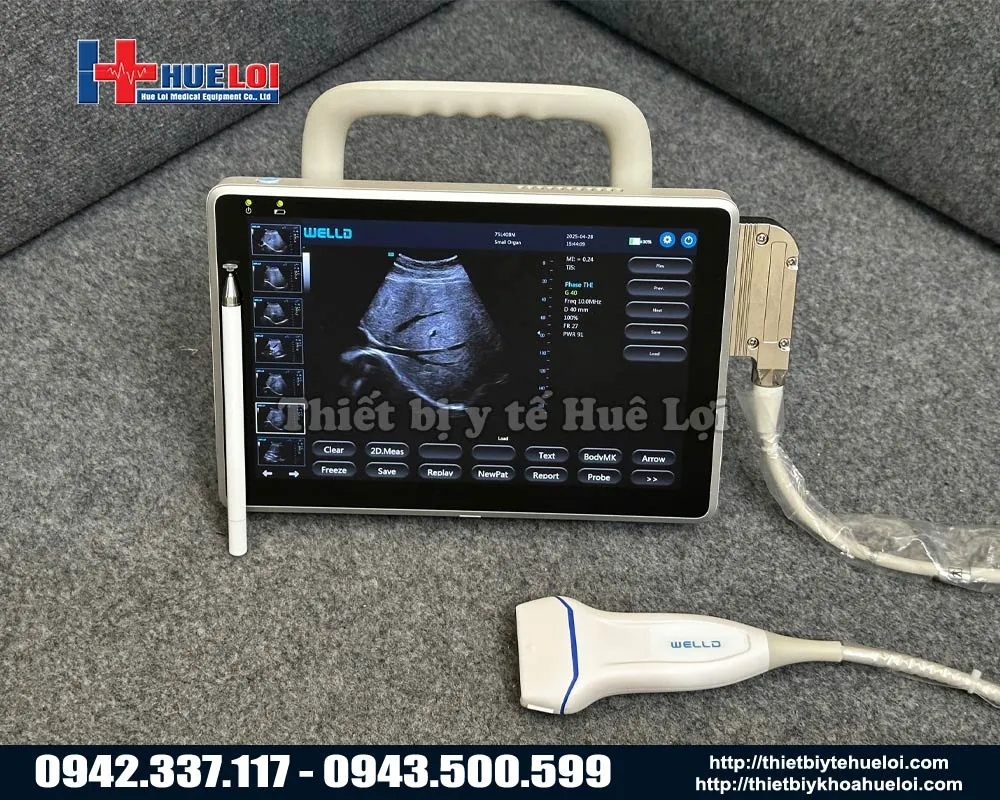 Máy siêu âm xách tay cảm ứng welld p10