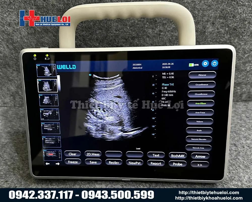 Máy siêu âm cảm ứng  xách tay giá rẻ