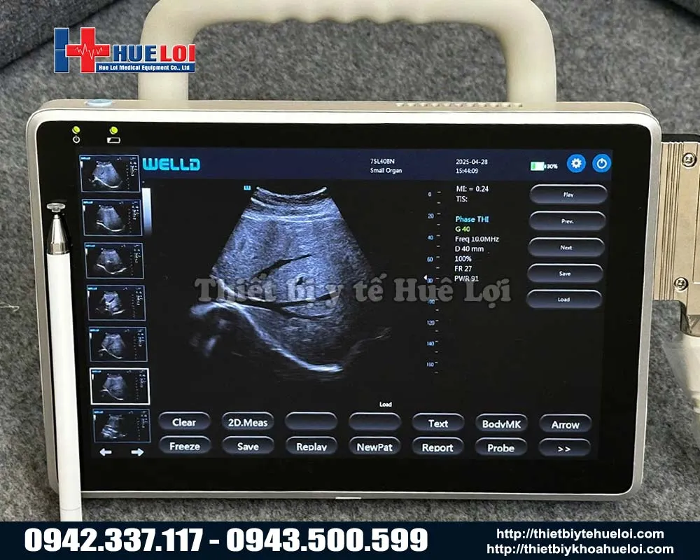 Máy siêu âm xách tay tốt nhất hiện nay
