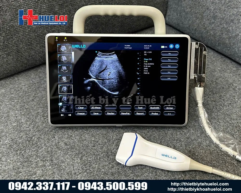 MÁY SIÊU ÂM XÁCH TAY TỐT NHẤT HIỆN NAY - WELL.D - P10