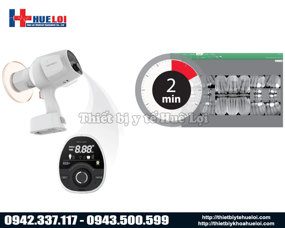 Máy chụp X quang răng thế hệ mới