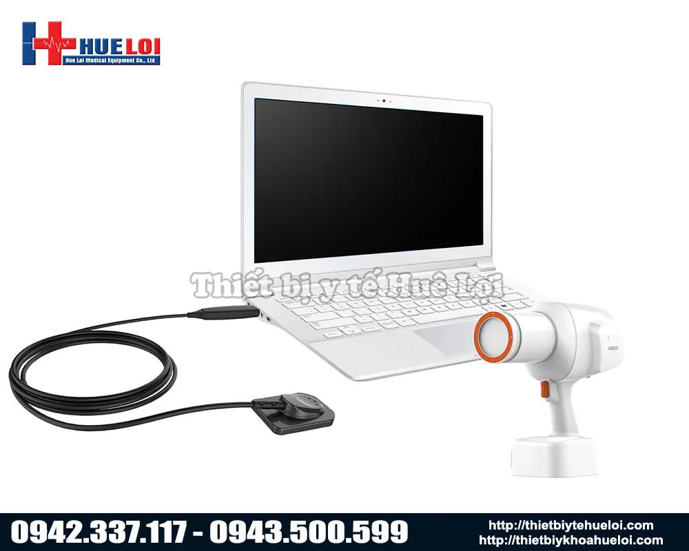 Kết nối máy chụp x-quang răng với màn hình máy tính