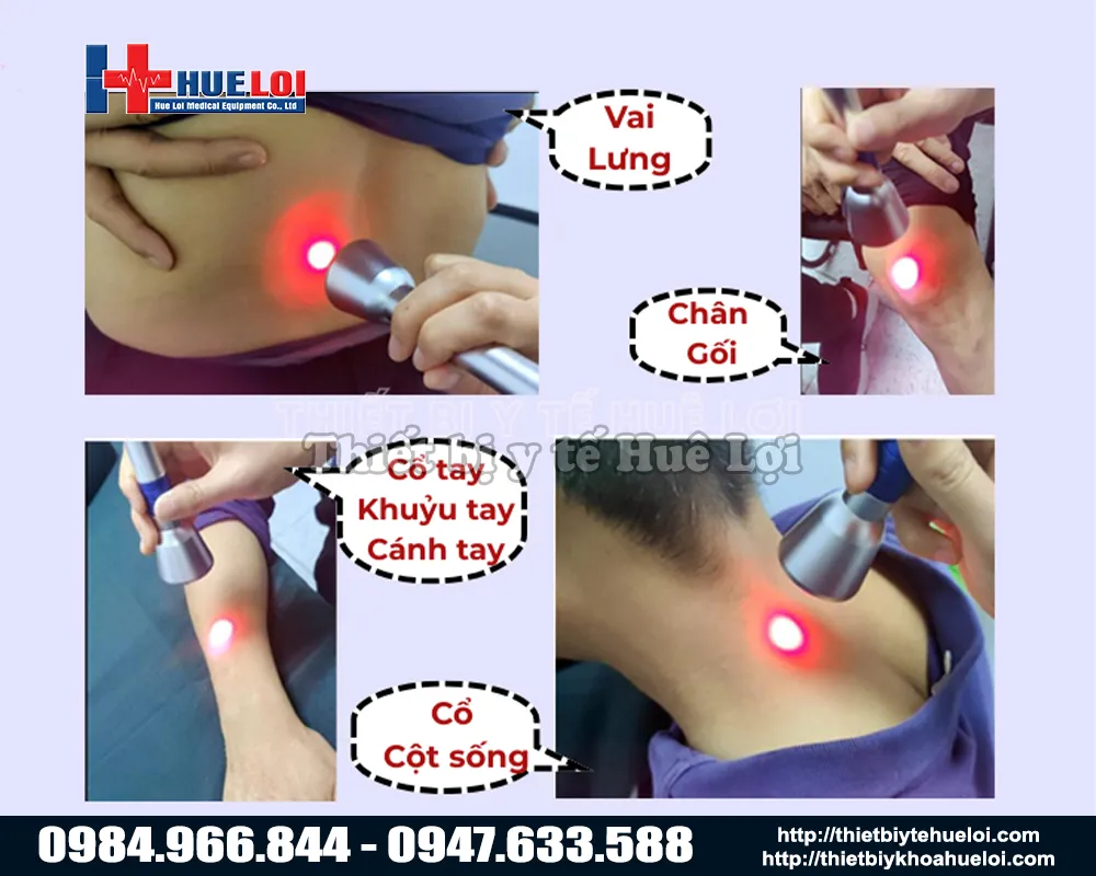 Ứng dụng thực tế của EC30 đa bước sóng trong trị liệu đau cơ - xương - khớp