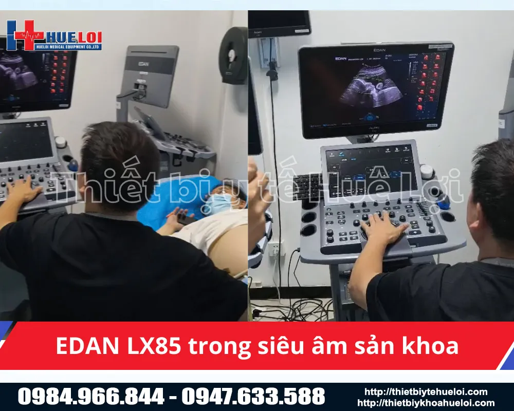 Thiết bị chẩn đoán hình ảnh 5d cao cấp lx85