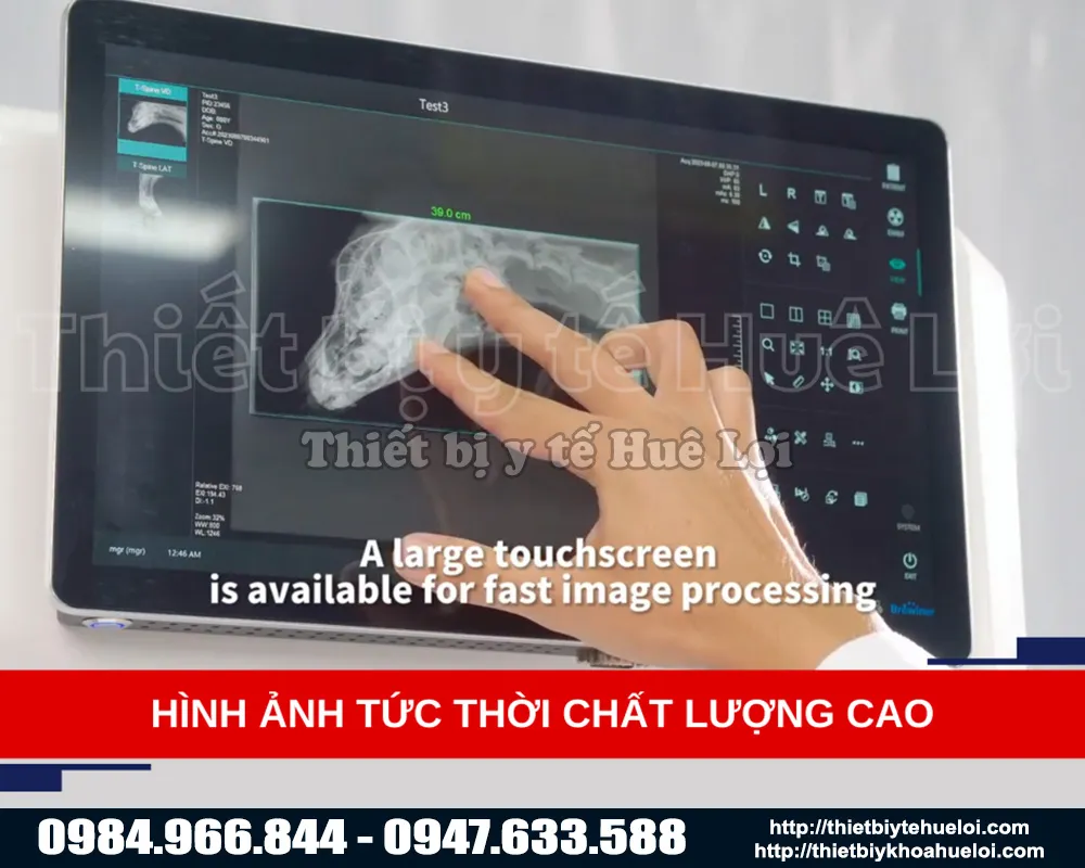 Hình ảnh chụp trên máy x quang thu y cố định