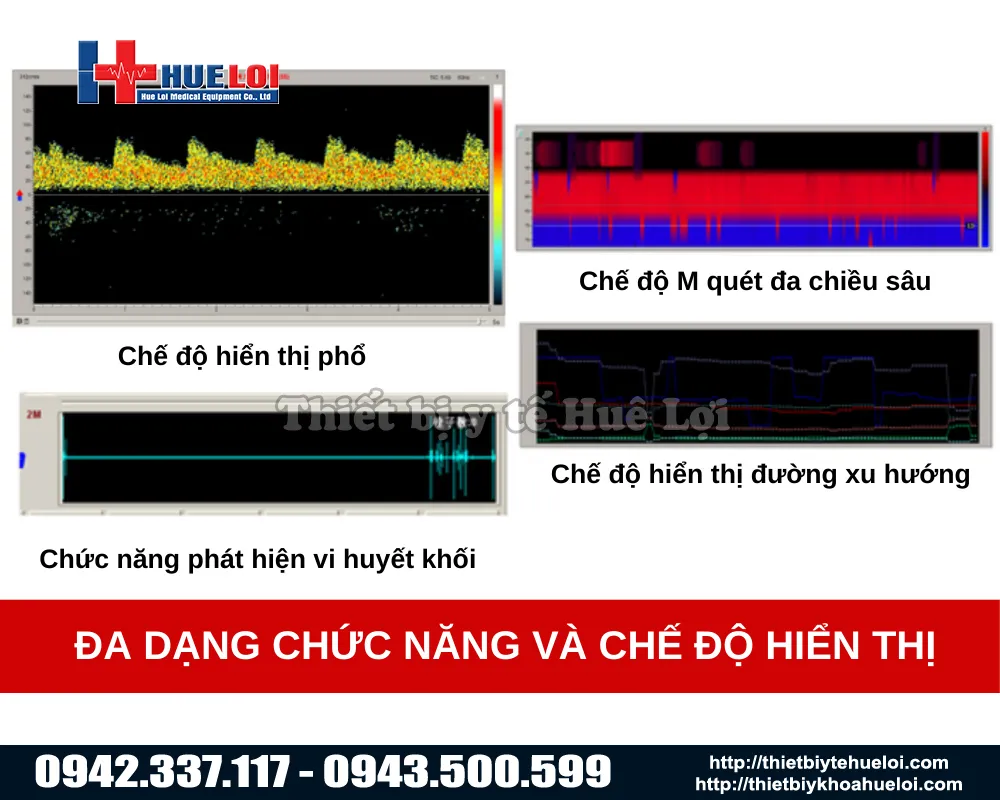 Máy phân tích lưu lượng máu Doppler xuyên sọ