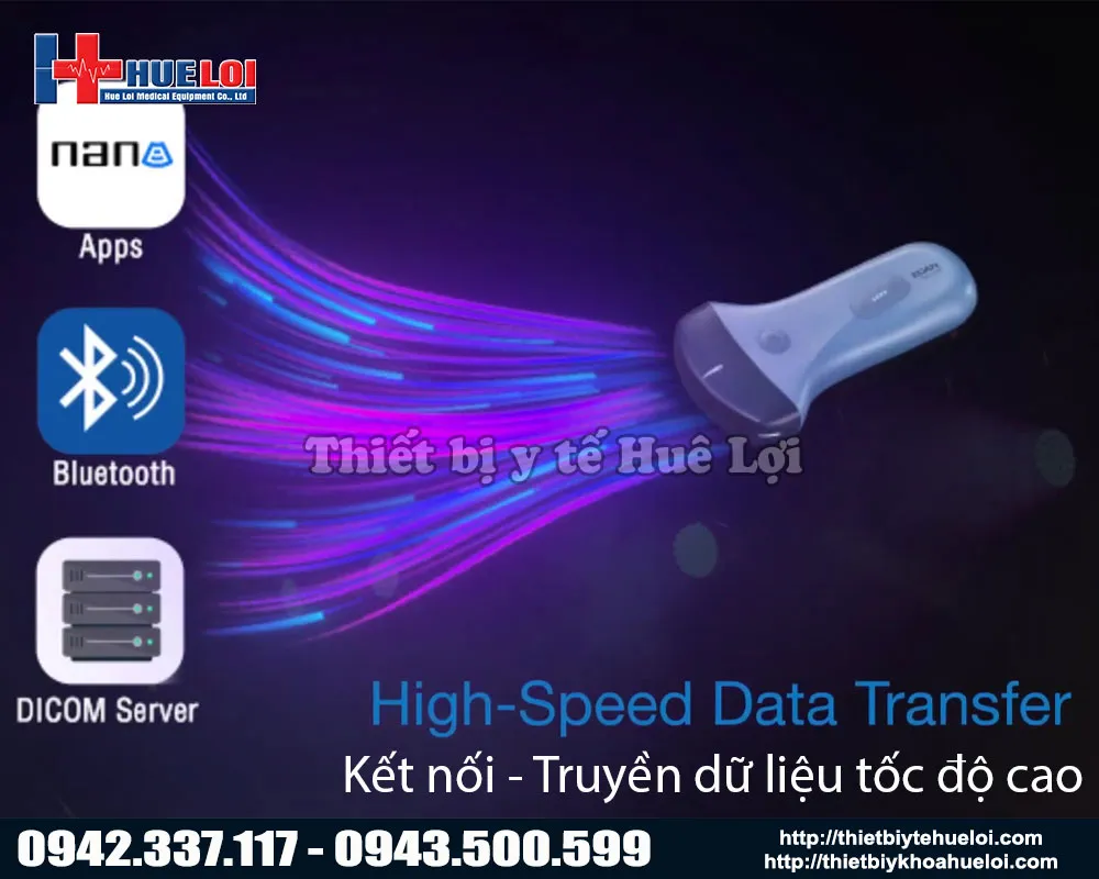 Khả năng kết nối dữ liệu của máy siêu âm di động edan