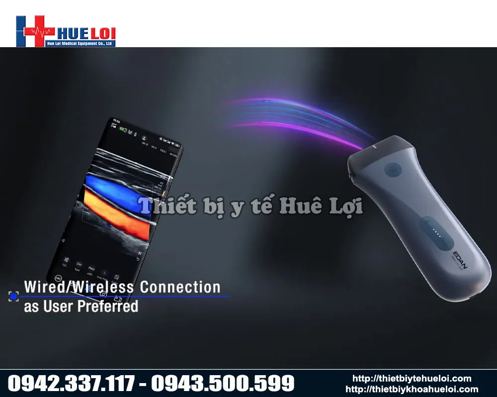 Hình thức kết nối không dây của máy siêu âm cầm tay giá rẻ