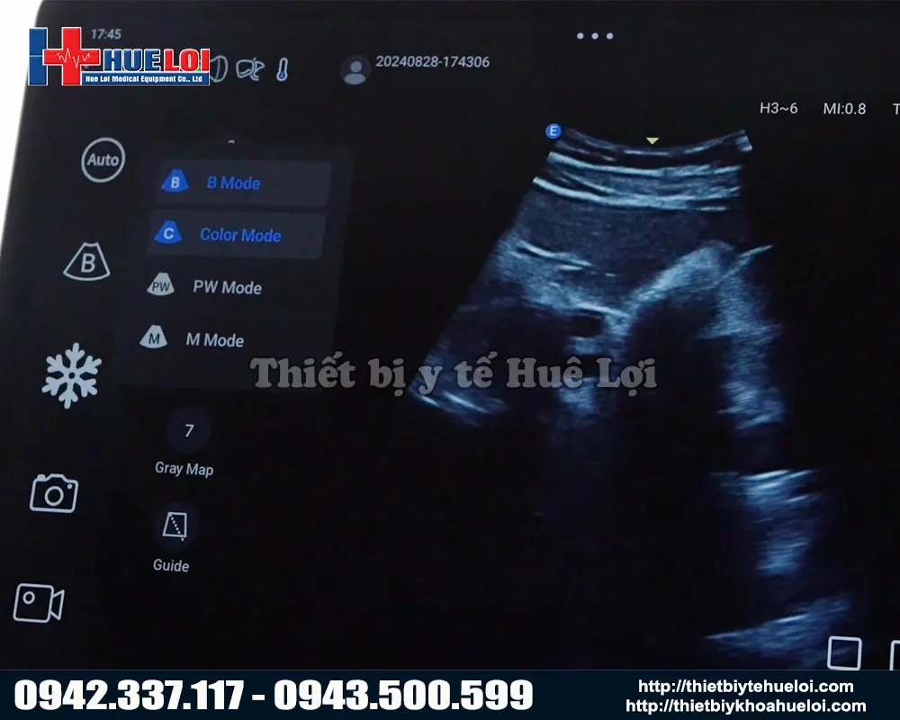 Các chế độ hình ảnh trên máy siêu âm chẩn đoán hình ảnh l12
