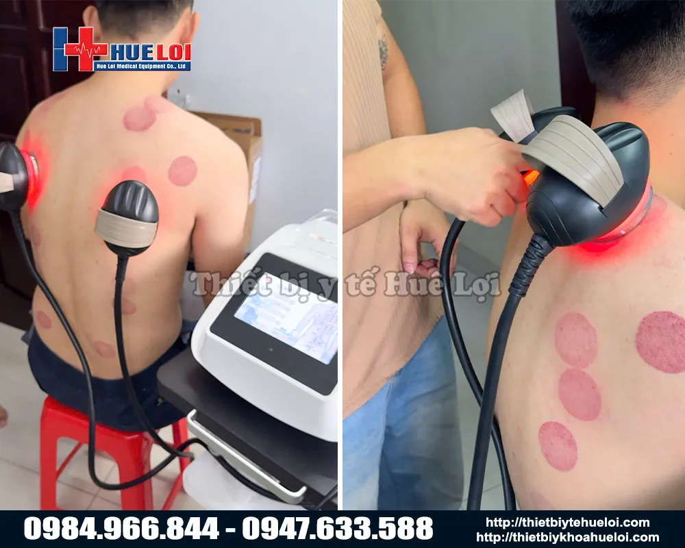 Đả thông kinh lạc bằng máy dds 3in1