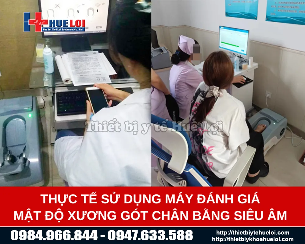 ứng dụng thực tế của máy đo mật độ canxi OSTEOKJ3000 tronh điều trị và thăm khám