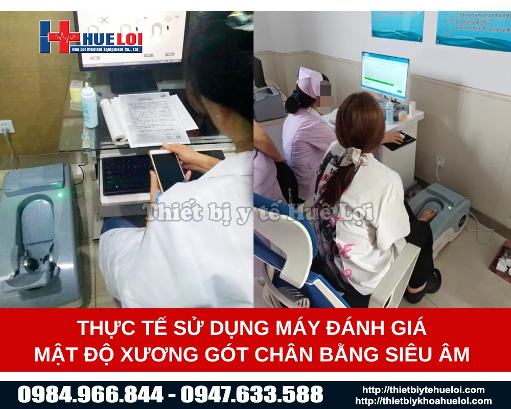 Ứng dụng của máy đo mật độ xương bằng sóng siêu âm OSTEOKJ3000M