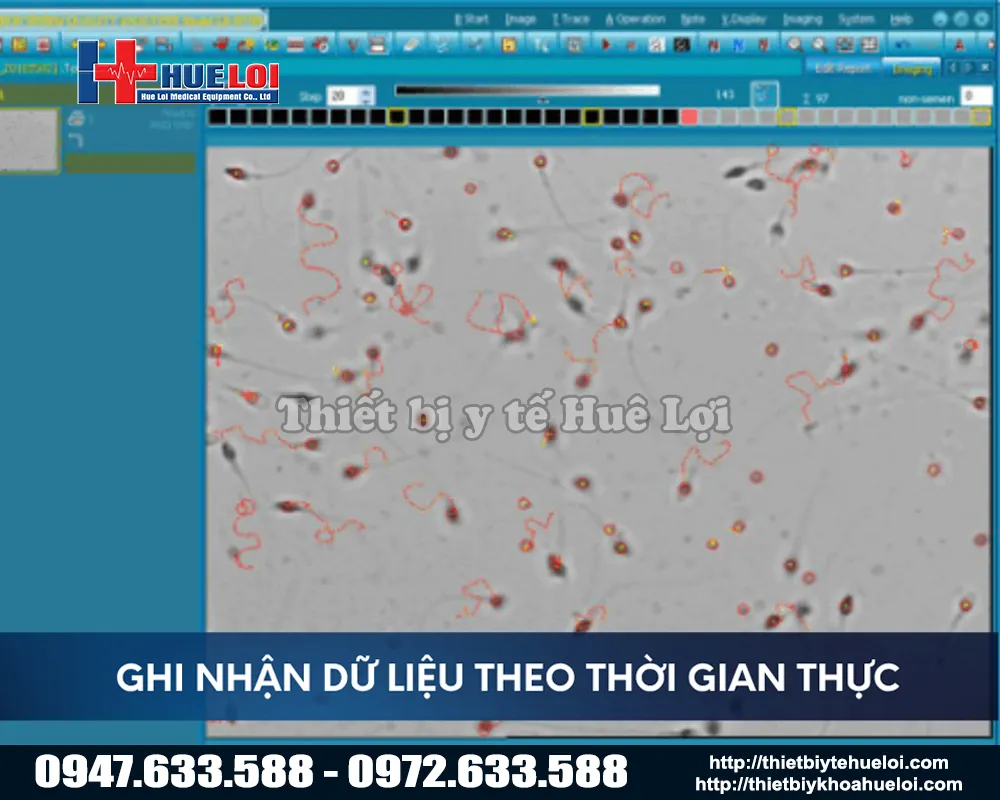 Hình ảnh thực tế tinh dịch thông qua máy phân tích dịch đồ