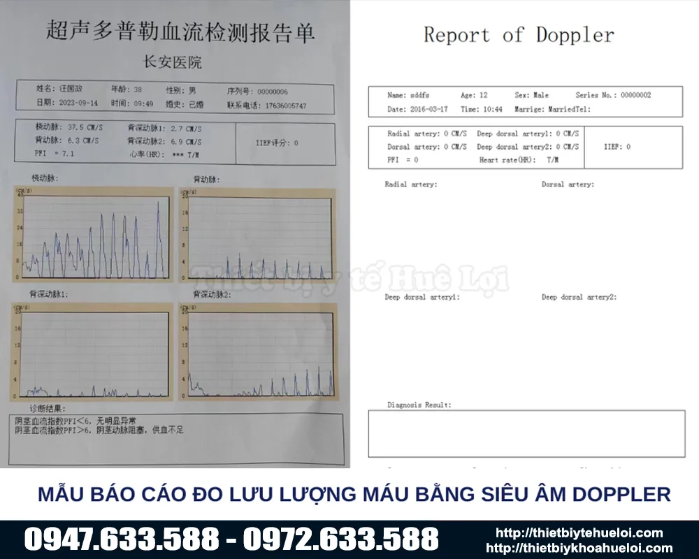 Báo cáo kết quả từ máy đo chức năng sinh lý nam giới