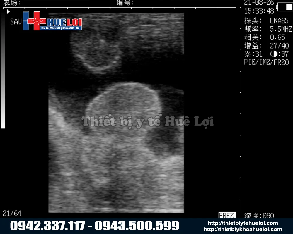 M&aacute;y si&ecirc;u &acirc;m h&igrave;nh ảnh th&uacute; y 2d gi&aacute; tốt