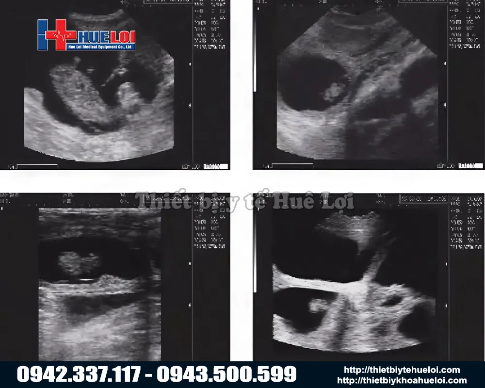 M&aacute;y si&ecirc;u &acirc;m Well D M3V 