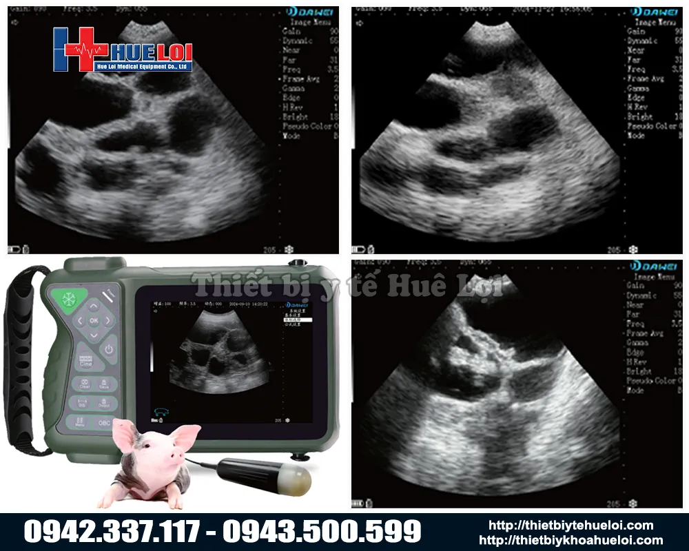 M&aacute;y chẩn đo&aacute;n thai cho lợn n&aacute;i di động gi&aacute; rẻ