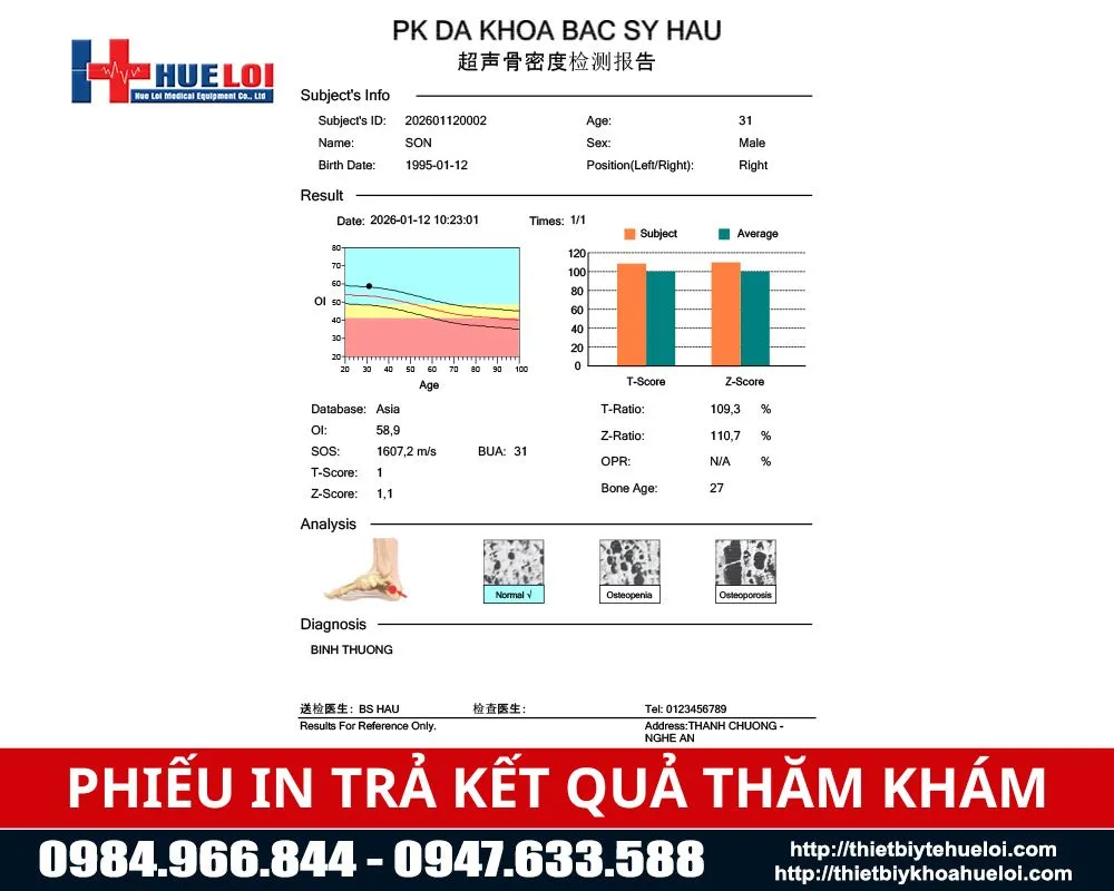 Phiếu in trả kết quả tham kh&aacute;m cuả m&aacute;y đo lo&atilde;ng xương g&oacute;t ch&acirc;n