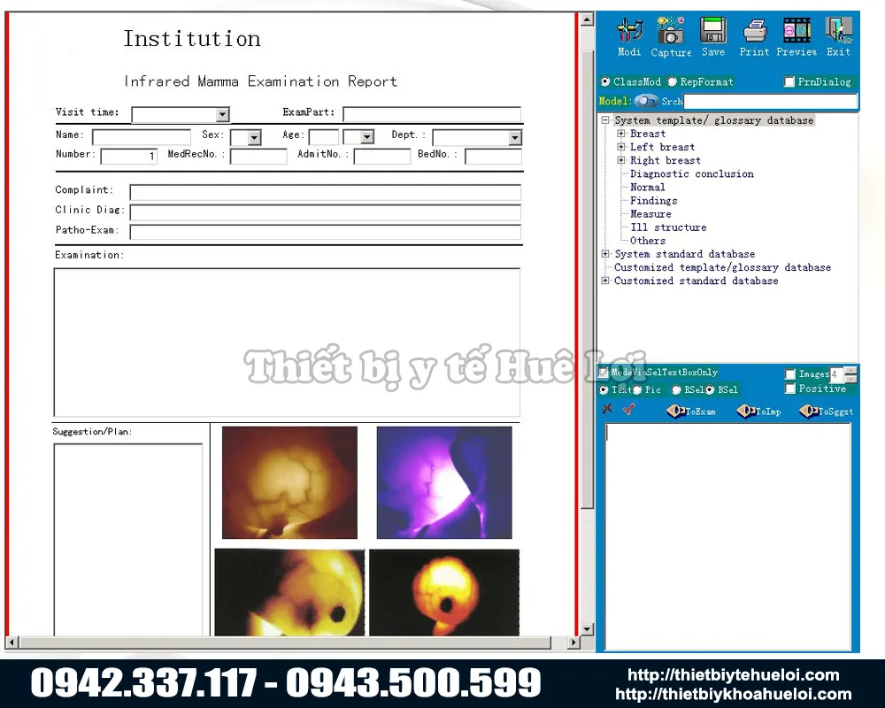 phần mềm thăm khám và trả kết quả của máy thăm khám tuyến vú sw 3002