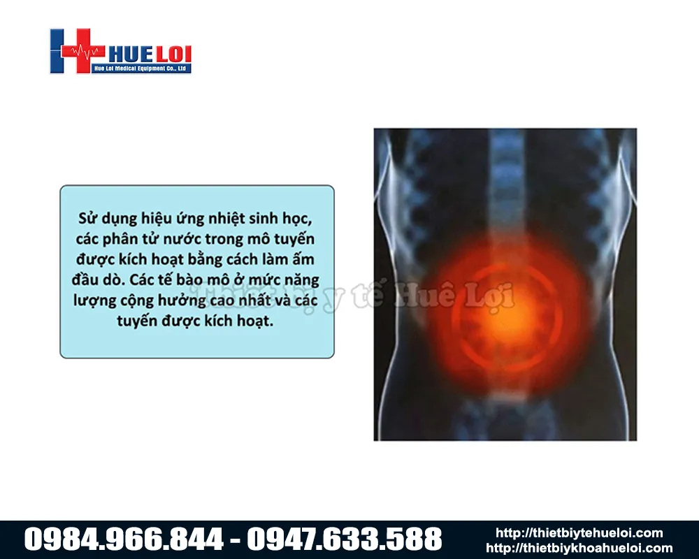 Công nghệ nhiệt trị liệu của máy điều trị tuyến tiền liệt