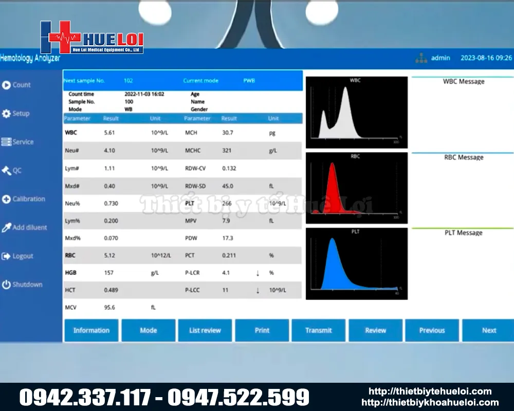 Bảng ph&acirc;n t&iacute;ch kết quả m&aacute;y x&eacute;t nghiệm m&aacute;u th&uacute; y tự động bha-300 vet