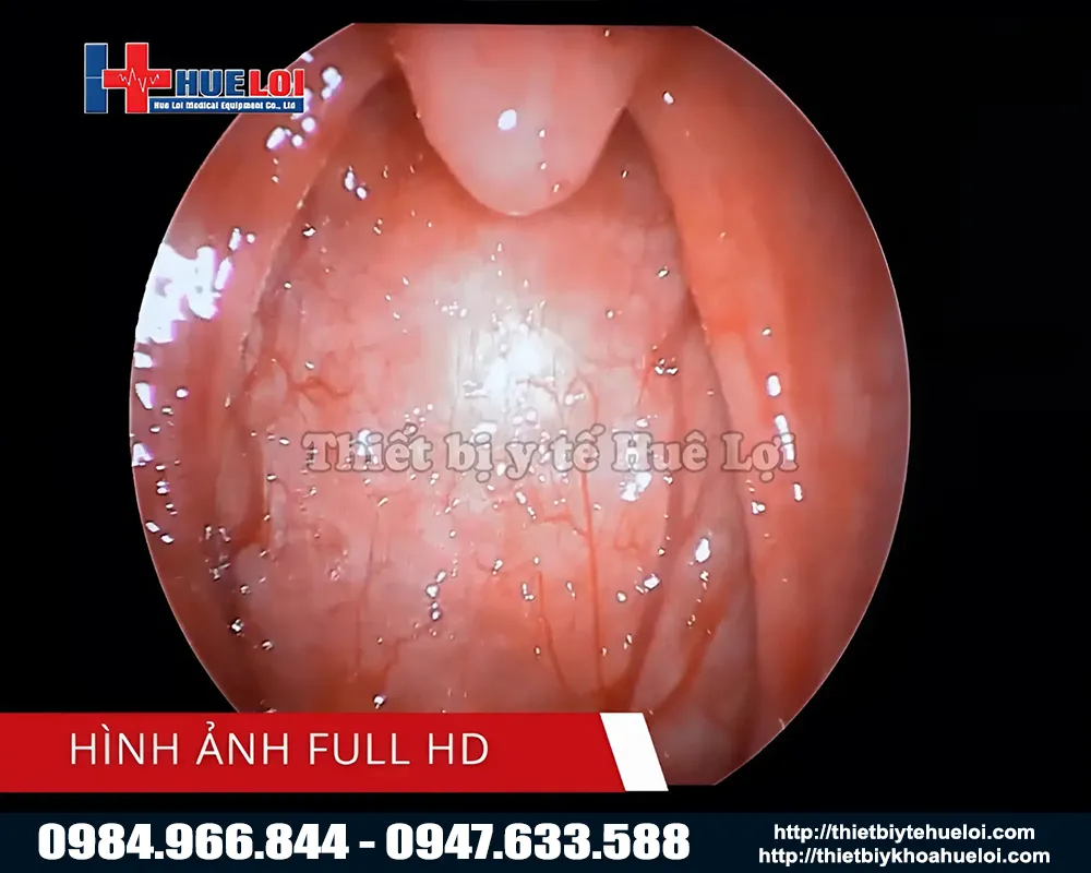 M&aacute;y nội soi tai mũi họng chất lượng cao full hd tj168b