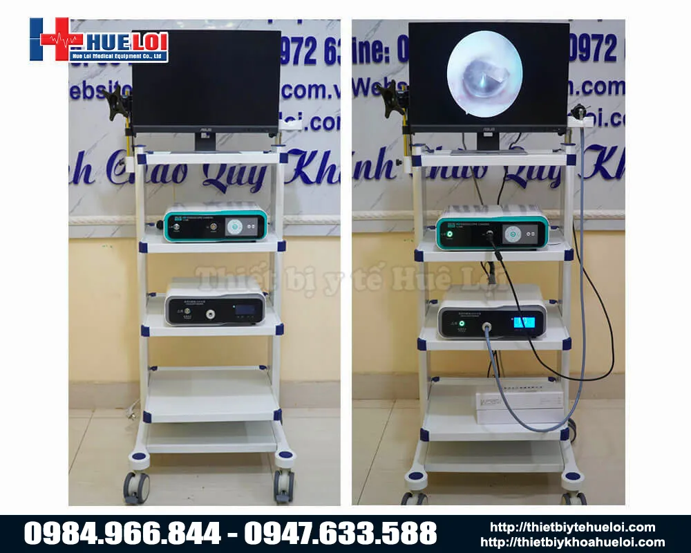 M&aacute;y nội soi tai mũi họng full HD TJ-168B