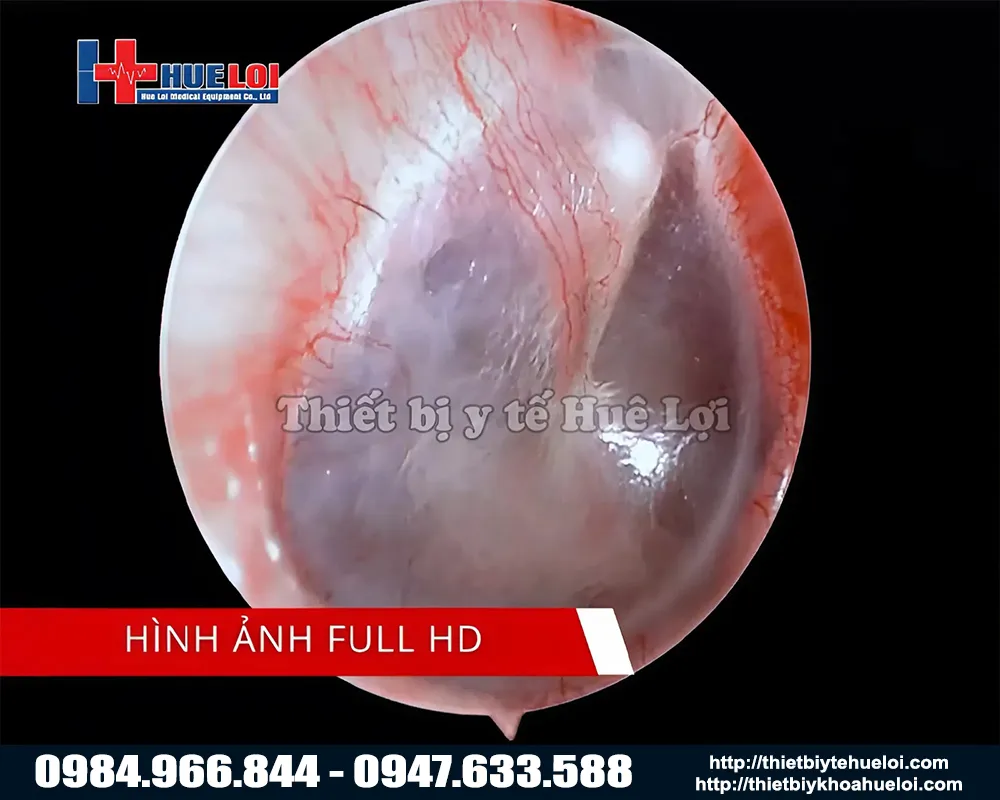 M&aacute;y nội soi tai mũi họng h&igrave;nh ảnh