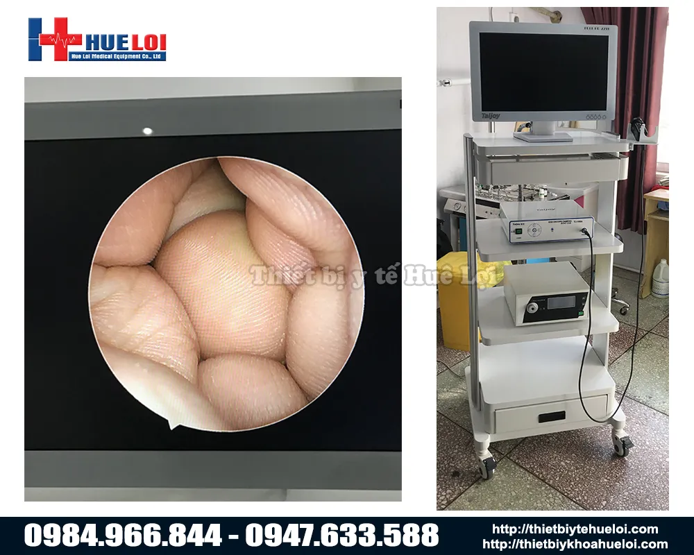 Hình ảnh thực tế từ Máy soi tai mũi họng SD TJ-168A