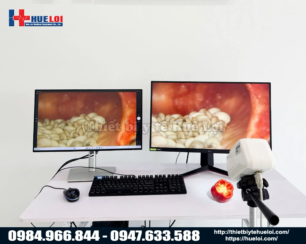 Thiết bị chẩn đo&aacute;n bệnh l&yacute; phụ khoa h&igrave;nh ảnh sd gi&aacute; rẻ