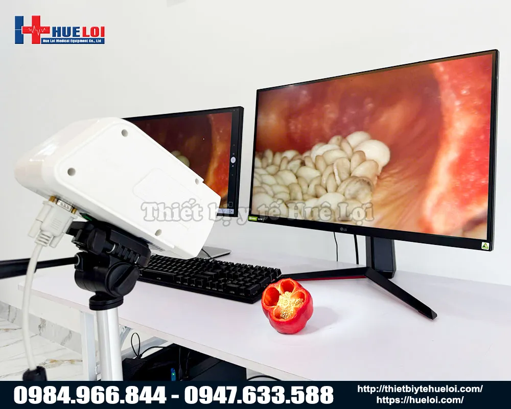 Chất lượng h&igrave;nh ảnh m&aacute;y soi cổ tử cung sanwe sw302