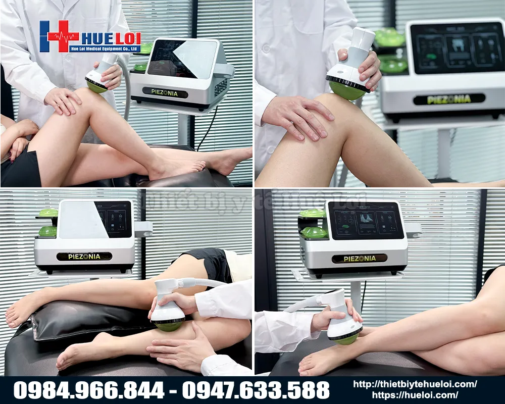 Ứng dụng trị liệu của m&aacute;y xung k&iacute;ch chọn độ s&acirc;u ti&ecirc;u điểm Piezonia PZO-G1