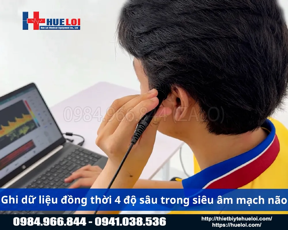 Ứng dụng của máy chẩn đoán hình ảnh xuyên sọ