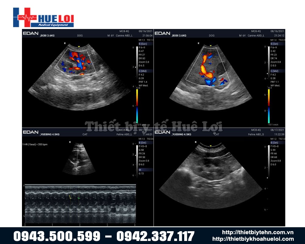 chất lượng hình ảnh siêu âm