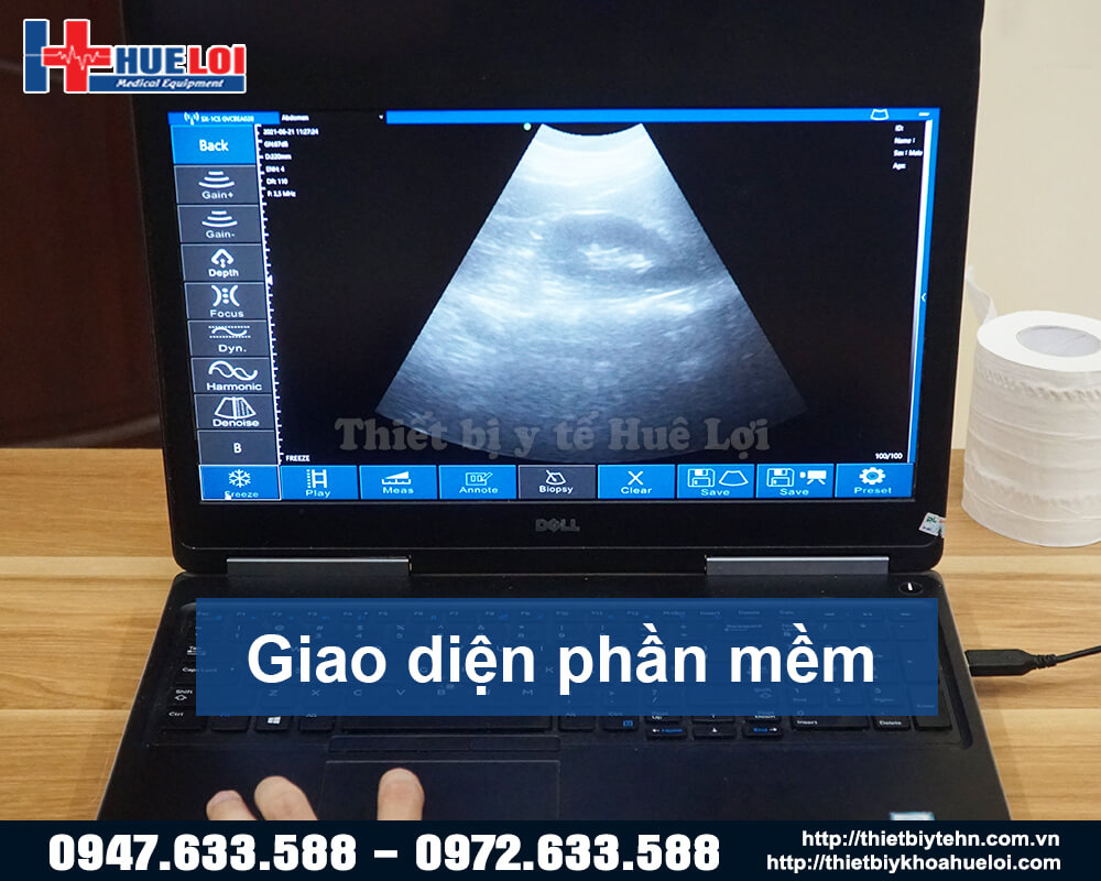 giao diện Máy siêu âm không dây 2 đầu dò