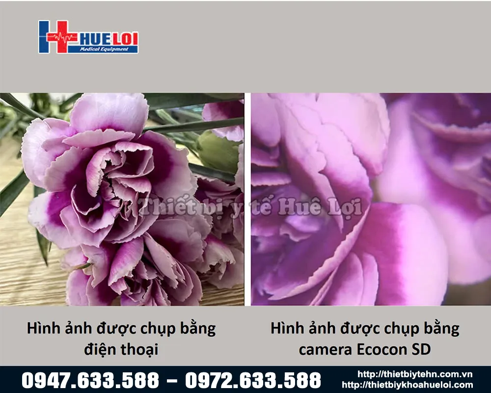 So sánh chất lượng hình ảnh máy soi cổ tử cung Ecocon SD